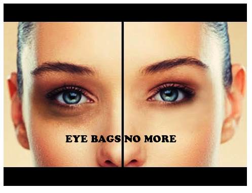 NO MORE EYEBAGS