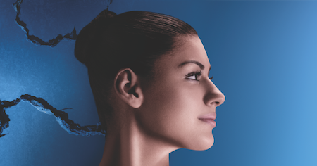 dry-skin-around-eyes-medium_tcm2858-989860